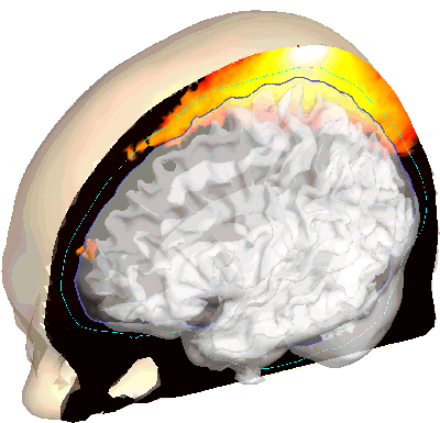 Brain atlas sensitivity