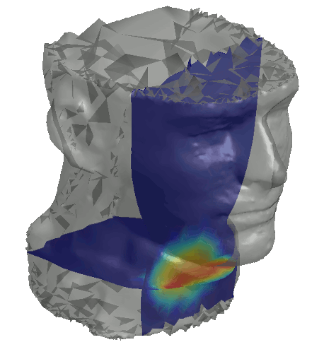 Head-neck sensitivity