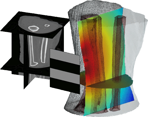 Tibia bone with structured illumination
